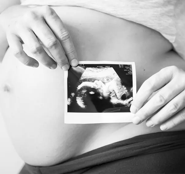 cyprus tup bebek sbmd