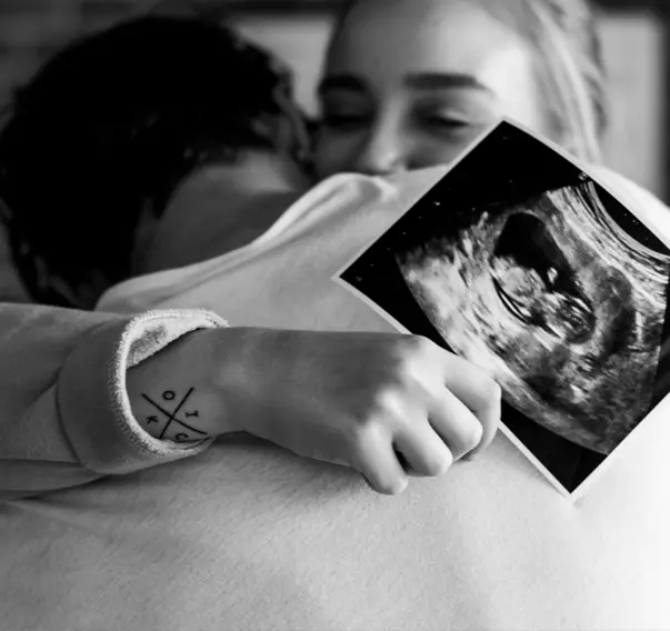 cyprus tup bebek sbmds